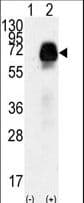 AMHR2 / MISRII Antibody (aa65-91)