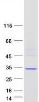 Human LRRC61 Protein (Recombinant Myc-DDK (Flag))