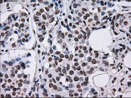 KIAA0153 / TTLL12 Antibody (clone OTI4B2)
