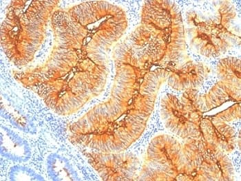 Monoclonal Mouse anti-Human TAG-72 Antibody (clone SPM148, IHC, IF)