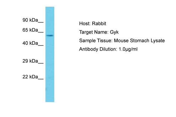 GK / Glycerol Kinase Antibody (aa101-150)