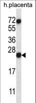 Polyclonal Rabbit anti-Human RNASE8 Antibody (aa104-132, WB)