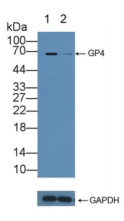 Polyclonal Rabbit anti-Human CD36 Antibody (aa187-428, WB)