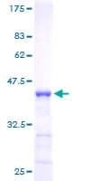 Human NUMB Protein (Recombinant GST)