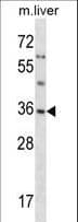 Polyclonal Rabbit anti-Human SGTA / SGT Antibody (aa78-106, WB)