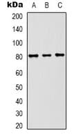 Polyclonal Rabbit anti-Human ASIC1 / ACCN2 Antibody (IHC, WB)