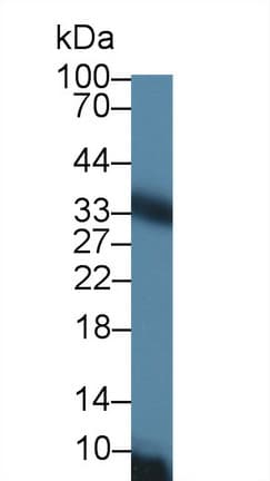 SLC25A20 / CACT Antibody (aa1-211, Cy3)