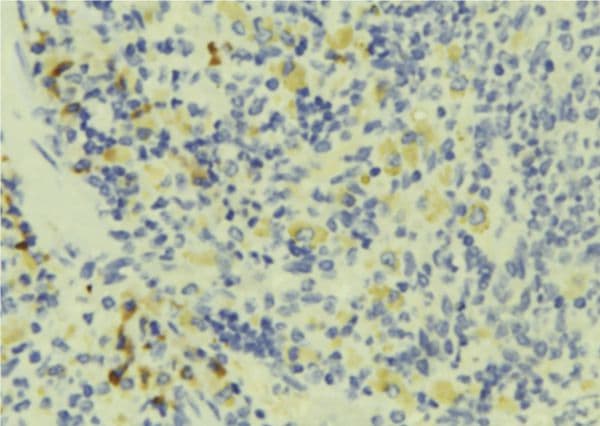 TMSB4X / Thymosin Beta-4 Antibody