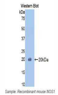 NOS1 / nNOS Antibody (aa455-601, Biotin)