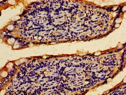 Polyclonal Rabbit anti-Human PTPRF Antibody (IHC)