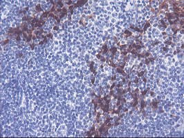 SERPINB2 / PAI-2 Antibody (clone 1G3, Carrier-free)