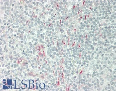 IHC-plus™ TNFSF4 / OX40L / CD252 Antibody (31-80 aa, Internal)