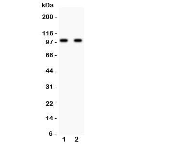 GRM2 / MGLUR2 Antibody (aa25-360)