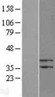 PTER Protein (Over-Expression Lysate Myc-DDK (Flag))