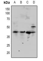 Polyclonal Rabbit anti-Human SMAD3 Antibody (IHC, WB)