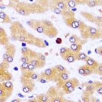 Polyclonal Rabbit anti-Human ATAD3B Antibody (IHC, WB)