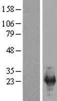 SREK1IP1 Protein (Over-Expression Lysate Myc-DDK (Flag))