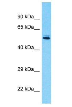 Polyclonal Rabbit anti-Human EIF5 Antibody (aa128-177, WB)