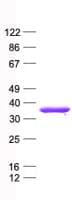 Human TP53TG5 Protein (Recombinant His, N-Terminal)