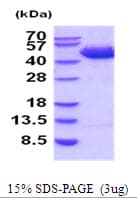 Human SERPINB3 Protein (Recombinant His)
