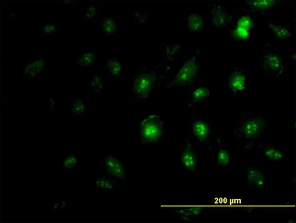 Monoclonal Mouse anti-Human ZIC4 Antibody (clone 3D5, IF, WB)