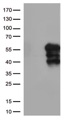 HAVCR2 / TIM-3 Antibody (clone OTI11A1)