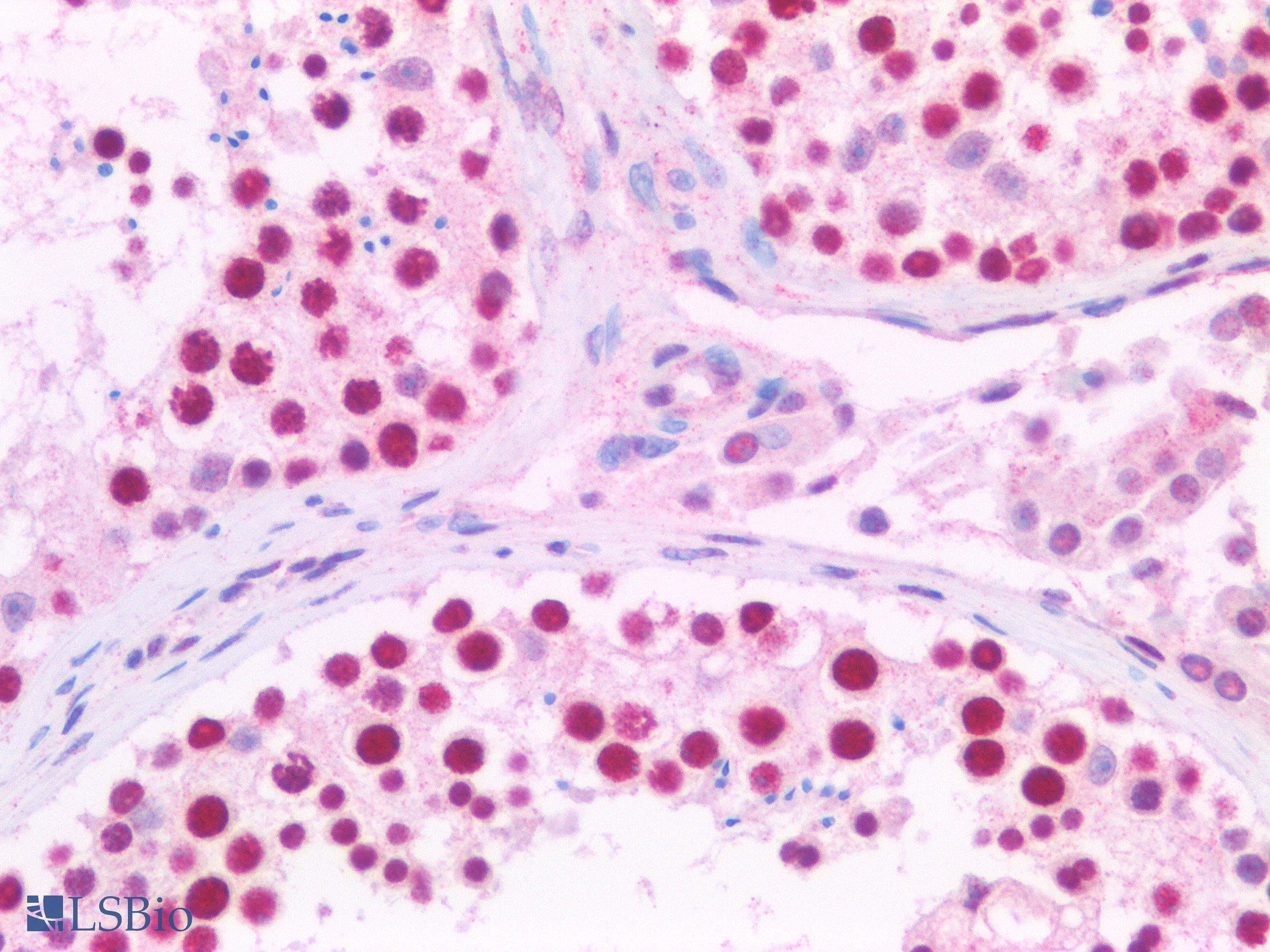IHC-plus™ CCND1 / Cyclin D1 Antibody (clone 3B6G3)