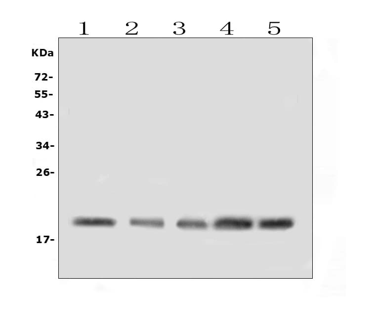 Polyclonal Rabbit anti-Human BAFF Receptor / CD268 Antibody (WB)