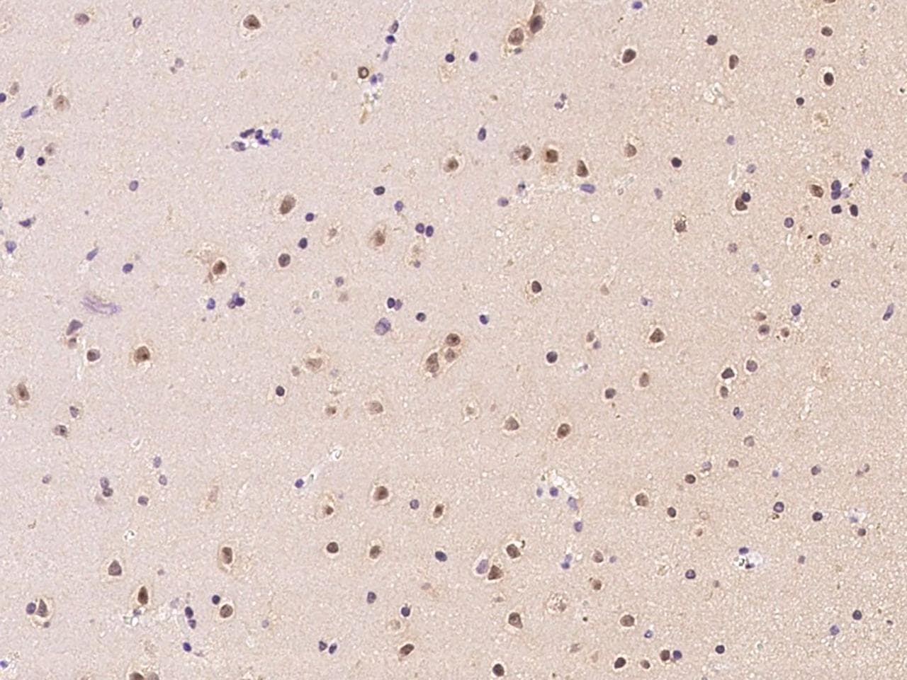 Aprataxin / APTX Antibody