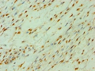 Polyclonal Rabbit anti-Human CLOCK Antibody (aa577-846, IHC, WB)