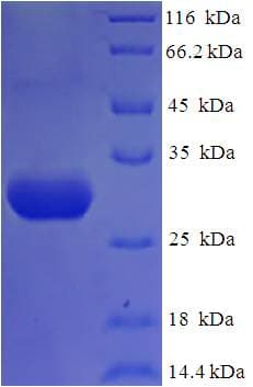 Human NPHS1 / Nephrin Protein (Recombinant 6His, N-terminus)