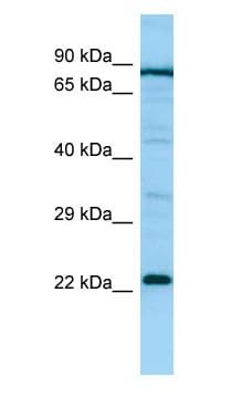 PTGES2 Antibody (aa86-135)