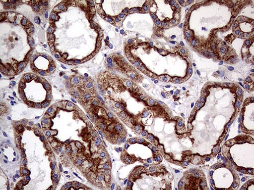 Monoclonal Mouse anti-Human CLTA / LCA Antibody (clone OTI2A6, IHC, WB)