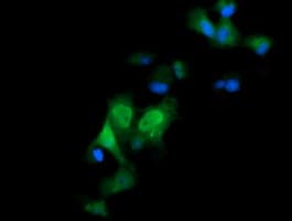 ERG Antibody (clone OTI6A4)