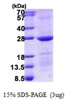 Human RAB10 Protein (Recombinant His)