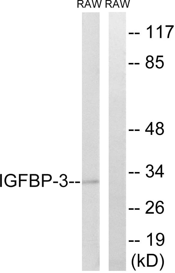 IGFBP3 Antibody (aa151-200)