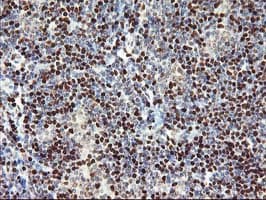 MEF2C Antibody (clone OTI1B6)