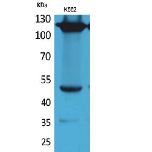 Polyclonal Rabbit anti-Human ITGA4 / VLA-4 / CD49d Antibody (571-620 aa, Internal, WB)