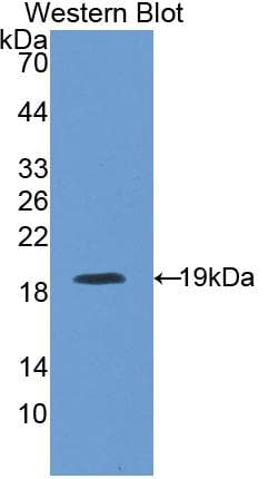 Properdin / CFP Antibody (aa54-217, APC)