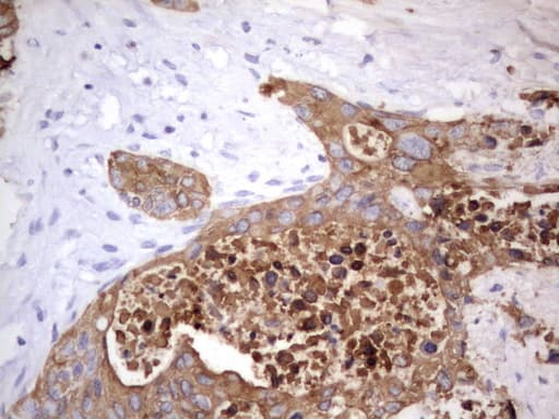 Monoclonal Rat anti-Human Acidic Cytokeratin Antibody (clone 2G10, IHC)