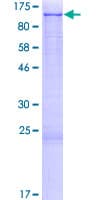 Human AFAP1 / AFAP Protein (Recombinant GST)