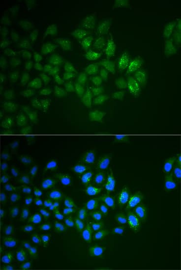 IHC-plus™ SYT1 / Synaptotagmin Antibody