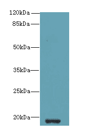 ZBTB8OS Antibody