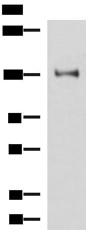 PRPF40A / FNBP3 Antibody