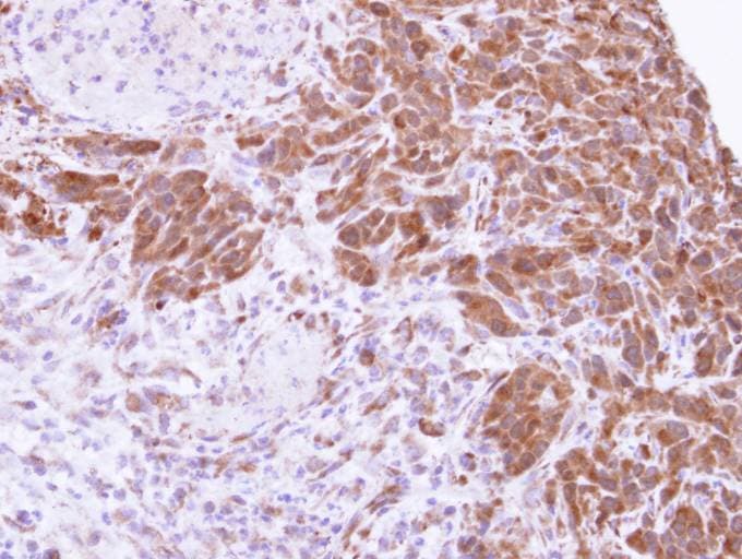 MTAP Antibody (aa1-283)