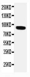 Polyclonal Rabbit anti-Human VRL1 / TRPV2 Antibody (aa42-624, IHC, WB)