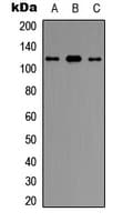 UBE3C Antibody (Internal)