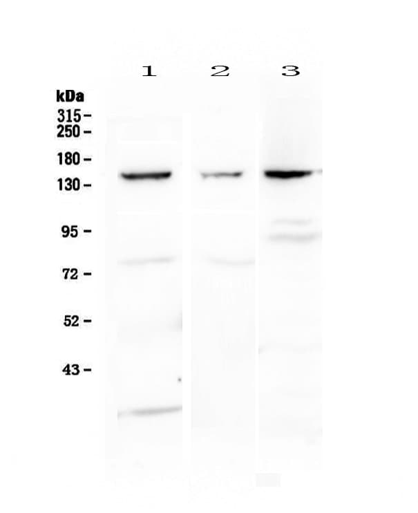 Polyclonal Rabbit anti-Human FLT1 / VEGFR1 Antibody (WB)