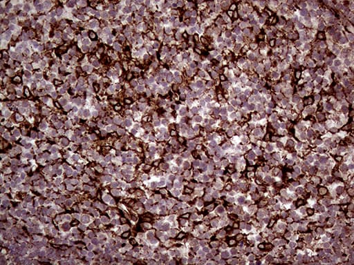 Monoclonal Mouse anti-Human ERLIN1 / SPFH1 Antibody (clone OTI4B1, aa107-346, IHC, WB)