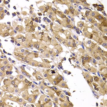 Polyclonal Rabbit anti-Human ASMTL Antibody (IHC, WB)